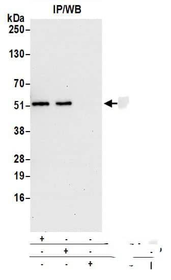 Immunoprecipitation:[NBP3-29362]-Detection of human CNDP2 by western blot of immunoprecipitates. Samples: Whole cell lysate from 293T cells prepared using NETN lysis buffer. Antibodies: Affinity purified rabbit anti-CNDP2 antibody used for IP at 6 µg per reaction. CNDP2 was also immunoprecipitated by rabbit anti-CNDP2 antibody. For blotting immunoprecipitated CNDP2, was used at 1 µg/ml. Detection: Chemiluminescence with an exposure time of 30 seconds.