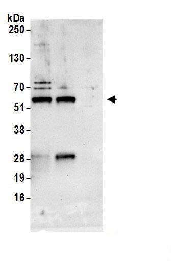 Immunoprecipitation:NARFL AntibodyNBP3-29363] -Detection of human NARFL by western blot of immunoprecipitates. Samples: Whole cell lysate (1.0 mg per IP reaction; 20% of IP loaded) from HeLa cells prepared using NETN lysis buffer. Antibodies: Affinity purified rabbit anti-NARFL antibody (NBP3-29363 lot 1) used for IP at 6 µg per reaction. NARFL was also immunoprecipitated by rabbit anti-NARFL.. For blotting immunoprecipitated NARFL, NBP3-29363 was used at 0.4 mg/ml. Detection: Chemiluminescence with an exposure time of 30 seconds.