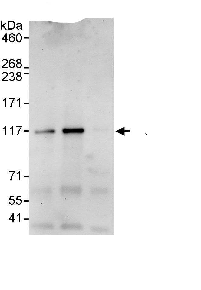 Immunoprecipitation:ANKRD52 AntibodyNBP3-29364] -Detection of human ANKRD52 by western blot of immunoprecipitates. Samples: Whole cell lysate (1 mg for IP, 20% of IP loaded) from HeLa cells. Antibodies: Affinity purified rabbit anti-ANKRD52 antibody NBP3-29364 used for IP at 10 µg/mg lysate. ANKRD52 was also immunoprecipitated by rabbit anti-ANKRD52 antibody BL5678, which recognizes a downstream epitope. For blotting immunoprecipitated ANKRD52, NBP3-29364 was used at 1 µg/ml. Detection: Chemiluminescence with an exposure time of 30 seconds.