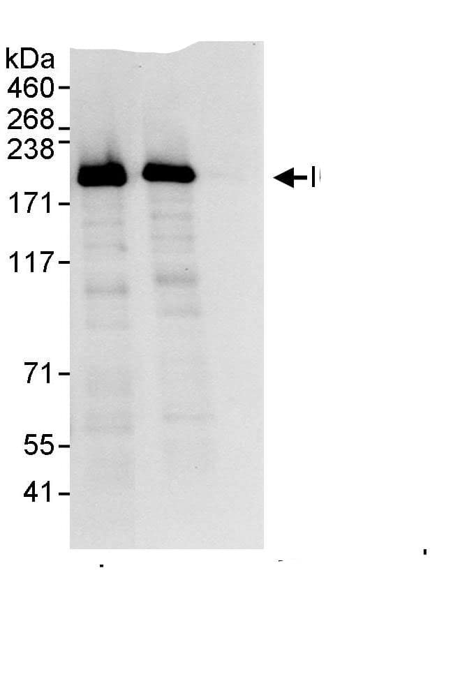 Immunoprecipitation:Intron-Binding Protein Of 160 KDa AntibodyNBP3-29365] -Detection of human IBP160 by western blot of immunoprecipitates. Samples: Whole cell lysate (1 mg for IP, 20% of IP loaded) from HeLa cells. Antibodies: Affinity purified rabbit anti-IBP160 antibody NBP3-29365 used for IP at 3 µg/mg lysate. IBP160 was also immunoprecipitated by rabbit anti-IBP160., which recognizes a downstream epitope. For blotting immunoprecipitated IBP160,  was used at 1 µg/ml. Detection: Chemiluminescence with an exposure time of 3 seconds.