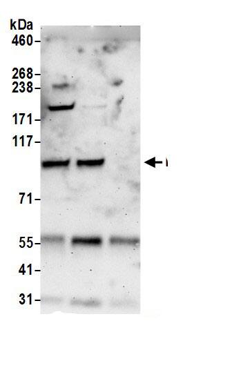 Immunoprecipitation:NVL AntibodyNBP3-29367] -Detection of human NVL by western blot of immunoprecipitates. Samples: Whole cell lysate (0.5 or 1.0 mg per IP reaction; 20% of IP loaded) from HeLa cells prepared using NETN lysis buffer. Antibodies: Affinity purified rabbit anti-NVL antibody NBP3-29367 (lot NBP3-29367-1) used for IP at 6 µg per reaction. NVL was also immunoprecipitated by rabbit anti-NVL.. For blotting immunoprecipitated NVL, was used at 1 µg/ml. Detection: Chemiluminescence with an exposure time of 3 minutes.