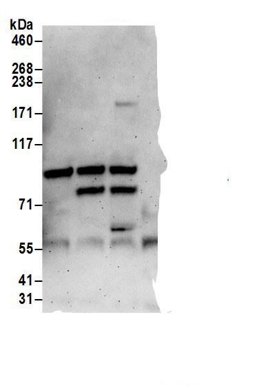 Immunoprecipitation:TOX4 AntibodyNBP3-29368] -Detection of human TOX4 by western blot of immunoprecipitates. Samples: Whole cell lysate (0.5 or 1.0 mg per IP reaction; 20% of IP loaded) from 293T cells prepared using NETN lysis buffer. Antibodies: Affinity purified rabbit anti-TOX4 antibody NBP3-29368 (lot NBP3-29368-1) used for IP at 6 µg per reaction. TOX4 was also immunoprecipitated by rabbit anti-TOX4 antibodies  . For blotting immunoprecipitated TOX4, NBP3-29368 was used at 0.4 µg/ml. Detection: Chemiluminescence with an exposure time of 3 minutes.