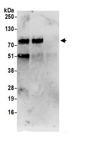 Immunoprecipitation:PAPD5 AntibodyNBP3-29369] -Detection of human PAPD5 by western blot of immunoprecipitates. Samples: Whole cell lysate (0.5 or 1.0 mg per IP reaction; 20% of IP loaded) from 293T cells prepared using NETN lysis buffer. Antibodies: Affinity purified rabbit anti-PAPD5 antibody NBP3-29369 (lot NBP3-29369-1) used for IP at 6 µg per reaction. PAPD5 was also immunoprecipitated by rabbit anti-PAPD5.. For blotting immunoprecipitated PAPD5,  was used at 1 µg/ml. Detection: Chemiluminescence with an exposure time of 3 minutes.