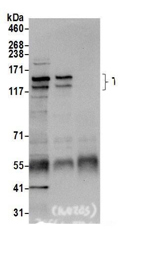 Immunoprecipitation:TBC1D1 AntibodyNBP3-29370] -Detection of human TBC1D1 by western blot of immunoprecipitates. Samples: Whole cell lysate (0.5 or 1.0 mg per IP reaction; 20% of IP loaded) from 293T cells prepared using NETN lysis buffer. Antibodies: Affinity purified rabbit anti-TBC1D1 antibody NBP3-29370 (lot NBP3-29370-1) used for IP at 6 µg per reaction. TBC1D1 was also immunoprecipitated by rabbit anti-TBC1D1.. For blotting immunoprecipitated TBC1D1, NBP3-29370 was used at 0.4 µg/ml. Detection: Chemiluminescence with an exposure time of 10 seconds.