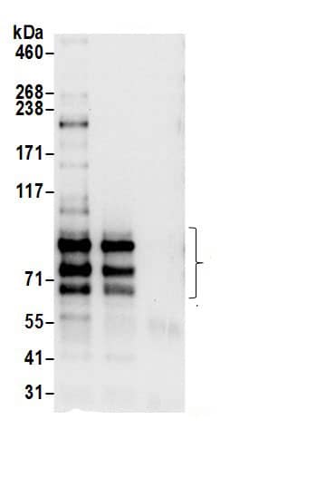 Immunoprecipitation:SPG20 AntibodyNBP3-29373] -Detection of human SPG20 by western blot of immunoprecipitates. Samples: Whole cell lysate (0.5 or 1.0 mg per IP reaction; 20% of IP loaded) from HeLa cells prepared using NETN lysis buffer. Antibodies: Affinity purified rabbit anti-SPG20 antibody NBP3-29373 (lot NBP3-29373-1) used for IP at 6 µg per reaction. SPG20 was also immunoprecipitated by rabbit anti-SPG20.. For blotting immunoprecipitated SPG20, NBP3-29373 was used at 1 µg/ml. Detection: Chemiluminescence with an exposure time of 10 seconds.