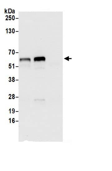 Immunoprecipitation:Asparagine synthetase AntibodyNBP3-29374] -Detection of human ASNS by western blot of immunoprecipitates. Samples: Whole cell lysate (0.5 or 1.0 mg per IP reaction; 20% of IP loaded) from 293T cells prepared using NETN lysis buffer. Antibodies: Affinity purified rabbit anti-ASNS antibody NBP3-29374 (lot NBP3-29374-1) used for IP at 6 µg per reaction. ASNS was also immunoprecipitated by rabbit anti-ASNS antibody BL21119. For blotting immunoprecipitated ASNS, NBP3-29374 was used at 0.4 µg/ml. Detection: Chemiluminescence with an exposure time of 10 seconds.