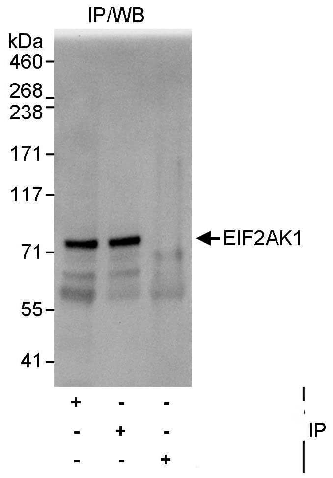 Immunoprecipitation:[NBP3-29375]-Detection of human EIF2AK1 by western blot of immunoprecipitates. Samples: Whole cell lysate from HeLa cells. Antibodies: Affinity purified rabbit anti-EIF2AK1 antibody used for IP at 10 µg/mg lysate. EIF2AK1 was also immunoprecipitated by rabbit anti-EIF2AK1 antibody , which recognizes a downstream epitope. For blotting immunoprecipitated EIF2AK1, was used at 1 µg/ml. Detection: Chemiluminescence with an exposure time of 10 seconds.