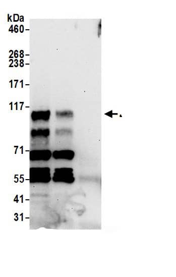 Immunoprecipitation:ZC3H7B AntibodyNBP3-29377] -Detection of human ZC3H7B by western blot of immunoprecipitates. Samples: Whole cell lysate (0.5 or 1.0 mg per IP reaction; 20% of IP loaded) from HeLa cells prepared using NETN lysis buffer. Antibodies: Affinity purified rabbit anti-ZC3H7B antibody NBP3-29377 (lot NBP3-29377-1) used for IP at 6 µg per reaction. ZC3H7B was also immunoprecipitated by rabbit anti-ZC3H7B.. For blotting immunoprecipitated ZC3H7B,  was used at 0.4 µg/ml. Detection: Chemiluminescence with an exposure time of 30 seconds.