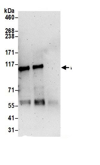 Immunoprecipitation:PLD1 AntibodyNBP3-29378] -Detection of human PLD1 by western blot of immunoprecipitates. Samples: Whole cell lysate (0.5 or 1.0 mg per IP reaction; 20% of IP loaded) from HeLa cells prepared using NETN lysis buffer. Antibodies: Affinity purified rabbit anti-PLD1 antibody NBP3-29378 (lot NBP3-29378-1) used for IP at 6 µg per reaction. PLD1 was also immunoprecipitated by rabbit anti-PLD1 antibody. For blotting immunoprecipitated PLD1, NBP3-29378 was used at 0.4 µg/ml. Detection: Chemiluminescence with an exposure time of 3 minutes.