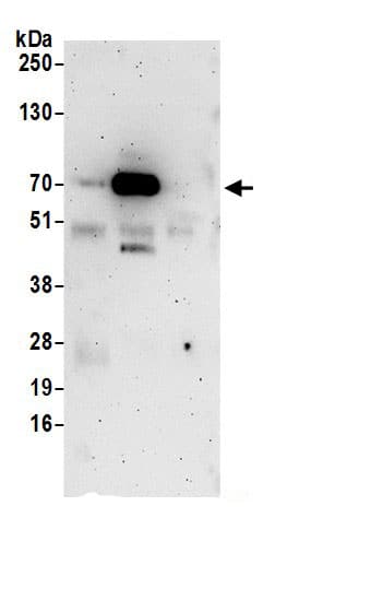 Immunoprecipitation:FKBP10 AntibodyNBP3-29380] -Detection of human FKBP10 by western blot of immunoprecipitates. Samples: Whole cell lysate (0.5 or 1.0 mg per IP reaction; 20% of IP loaded) from 293T and cells prepared using NETN lysis buffer. Antibodies: Affinity purified rabbit anti-FKBP10 antibody NBP3-29380 (lot NBP3-29380-1) used for IP at 6 µg per reaction. FKBP10 was also immunoprecipitated by rabbit anti-FKBP10.. For blotting immunoprecipitated FKBP10, NBP3-29380 was used at 1 µg/ml. Detection: Chemiluminescence with an exposure time of 3 minutes.