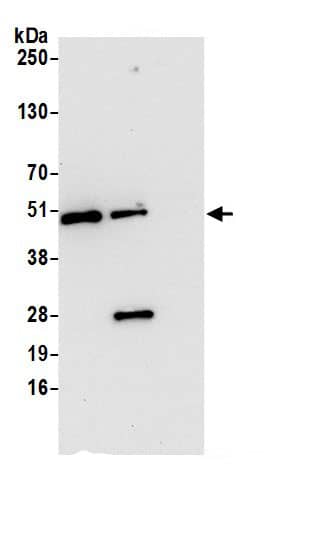 Immunoprecipitation:KAT1 AntibodyNBP3-29381] -Detection of human HAT1 by western blot of immunoprecipitates. Samples: Whole cell lysate (0.5 or 1.0 mg per IP reaction; 20% of IP loaded) from 293T cells prepared using NETN lysis buffer. Antibodies: Affinity purified rabbit anti-HAT1 antibody NBP3-29381 (lot NBP3-29381-1) used for IP at 6 µg per reaction. HAT1 was also immunoprecipitated by rabbit anti-HAT1 antibody. For blotting immunoprecipitated HAT1, NBP3-29381 was used at 0.4 µg/ml. Detection: Chemiluminescence with an exposure time of 10 seconds.