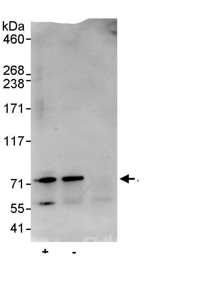 Immunoprecipitation:MED26 AntibodyNBP3-29383] -Detection of human CRSP7 by western blot of immunoprecipitates. Samples: Whole cell lysate (1 mg for IP, 20% of IP loaded) from HeLa cells. Antibodies: Affinity purified rabbit anti-CRSP7 antibody NBP3-29383 used for IP at 10 µg/mg lysate. CRSP7 was also immunoprecipitated by rabbit anti-CRSP7., which recognizes an upstream epitope. For blotting immunoprecipitated CRSP7, was used at 0.4 µg/ml. Detection: Chemiluminescence with an exposure time of 15 seconds.