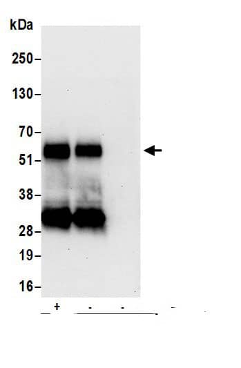 Immunoprecipitation:Lymphotoxin beta R/TNFRSF3 AntibodyNBP3-29385] -Detection of human LTBR by western blot of immunoprecipitates. Samples: Whole cell lysate (0.5 or 1.0 mg per IP reaction; 20% of IP loaded) from HeLa cells prepared using NETN lysis buffer. Antibodies: Affinity purified rabbit anti-LTBR antibody NBP3-29385 (lot NBP3-29385-1) used for IP at 6 µg per reaction. LTBR was also immunoprecipitated by rabbit anti-LTBR.. For blotting immunoprecipitated LTBR, NBP3-29385 was used at 0.4 µg/ml. Detection: Chemiluminescence with an exposure time of 30 seconds.