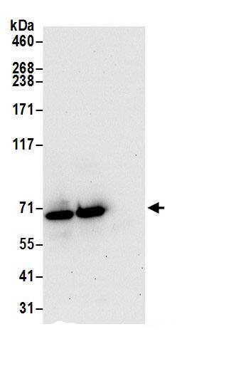 Immunoprecipitation:IQCB1 AntibodyNBP3-29386] -Detection of human IQCB1 by western blot of immunoprecipitates. Samples: Whole cell lysate (0.5 or 1.0 mg per IP reaction; 20% of IP loaded) from 293T cells prepared using NETN lysis buffer. Antibodies: Affinity purified rabbit anti-IQCB1 antibody NBP3-29386 (lot NBP3-29386-1) used for IP at 6 µg per reaction. IQCB1 was also immunoprecipitated by rabbit anti-IQCB1 antibody BL21694. For blotting immunoprecipitated IQCB1, NBP3-29386 was used at 1 µg/ml. Detection: Chemiluminescence with an exposure time of 30 seconds.