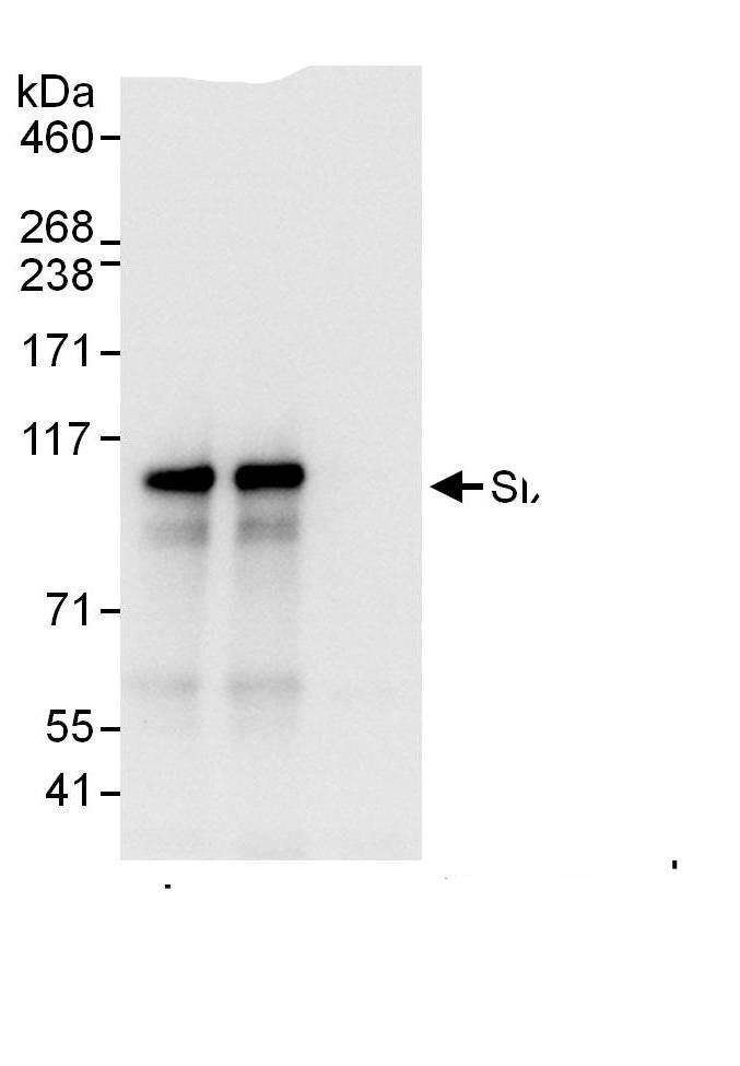 Immunoprecipitation:SIX4 AntibodyNBP3-29387] -Detection of human SIX4 by western blot of immunoprecipitates. Samples: Whole cell lysate (1 mg for IP, 20% of IP loaded) from HeLa cells. Antibodies: Affinity purified rabbit anti-SIX4 antibody NBP3-29387 used for IP at 6 µg/mg lysate. SIX4 was also immunoprecipitated by rabbit anti-SIX4., which recognizes a downstream epitope. For blotting immunoprecipitated SIX4,  was used at 0.4 µg/ml. Detection: Chemiluminescence with an exposure time of 3 seconds.