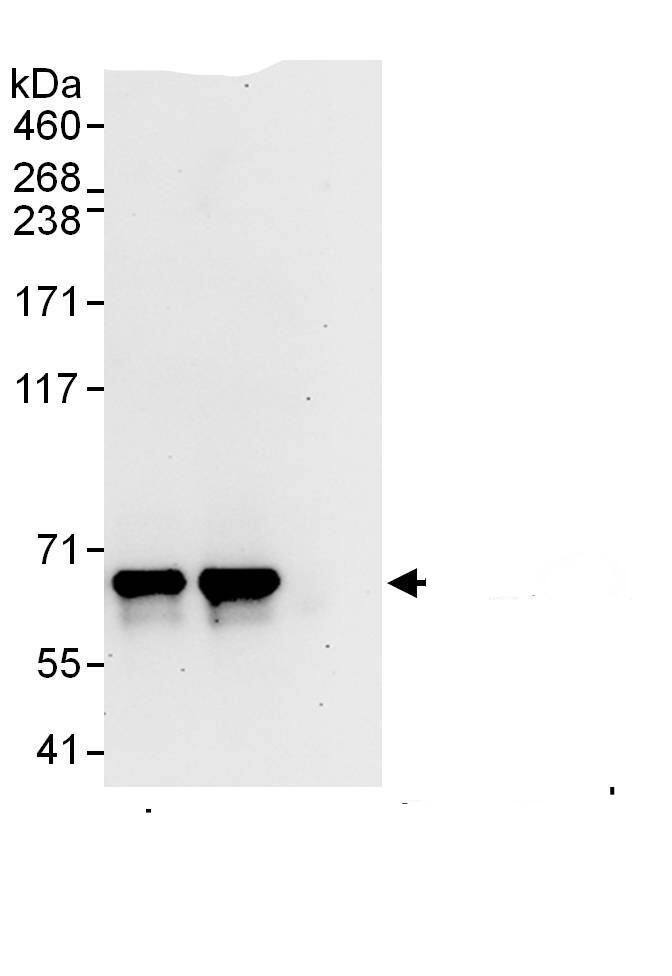 Immunoprecipitation:FASTKD2 AntibodyNBP3-29389] -Detection of human FASTKD2 by western blot of immunoprecipitates. Samples: Whole cell lysate (1 mg for IP, 20% of IP loaded) from HeLa cells. Antibodies: Affinity purified rabbit anti-FASTKD2 antibody NBP3-29389 used for IP at 6 µg/mg lysate. FASTKD2 was also immunoprecipitated by rabbit anti-FASTKD2., which recognizes a downstream epitope. For blotting immunoprecipitated FASTKD2,  was used at 1 µg/ml. Detection: Chemiluminescence with an exposure time of 30 seconds.