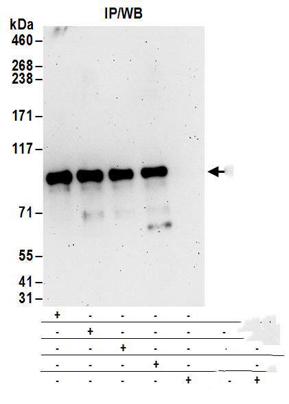 Immunoprecipitation:[NBP3-29390]-Detection of human DIXDC1 by western blot of immunoprecipitates. Samples: Whole cell lysate from 293T cells. Antibodies: Affinity purified rabbit anti-DIXDC1 antibody used for IP at 6 µg/mg lysate. DIXDC1 was also immunoprecipitated by rabbit anti-DIXDC1 antibodies , and. For blotting immunoprecipitated DIXDC1, was used at 1 µg/ml. Detection: Chemiluminescence with an exposure time of 3 minutes.