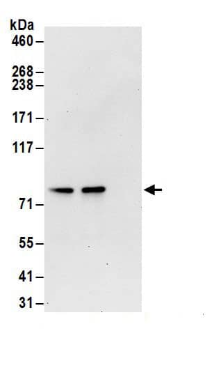 Immunoprecipitation:Transglutaminase 2/TGM2 AntibodyNBP3-29391] -Detection of human TG2 by western blot of immunoprecipitates. Samples: Whole cell lysate (1 mg for IP; 20% of IP loaded) from HeLa cells. Antibodies: Affinity purified rabbit anti-TG2 antibody NBP3-29391 (lot NBP3-29391-1) used for IP at 6 µg/mg lysate. TG2 was also immunoprecipitated by rabbit anti-TG2.. For blotting immunoprecipitated TG2, was used at 0.1 µg/ml. Detection: Chemiluminescence with an exposure time of 30 seconds.