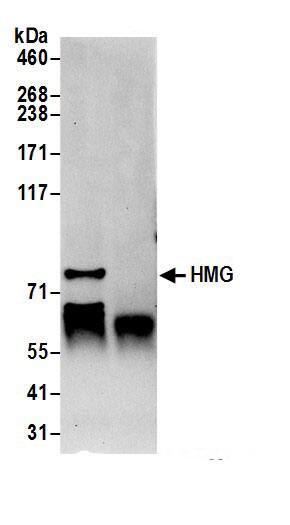 Immunoprecipitation:HMG2L1 AntibodyNBP3-29393] -Detection of human HMGXB4 by western blot of immunoprecipitates. Samples: Whole cell lysate (0.5 or 1.0 mg per IP reaction; 20% of IP loaded) from Jurkat cells prepared using NETN lysis buffer. Antibodies: Affinity purified rabbit anti-HMGXB4 antibody NBP3-29393 (lot NBP3-29393-1) used for IP at 6 µg per reaction. For blotting immunoprecipitated HMGXB4, NBP3-29393 was used at 1 µg/ml. Detection: Chemiluminescence with an exposure time of 30 seconds.