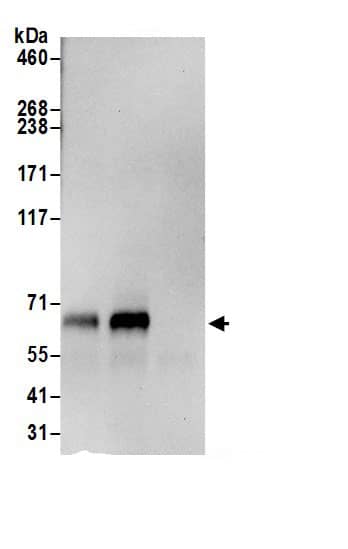 Immunoprecipitation:MTMR6 AntibodyNBP3-29397] -Detection of human MTMR6 by western blot of immunoprecipitates. Samples: Whole cell lysate (0.5 or 1.0 mg per IP reaction; 20% of IP loaded) from HeLa cells prepared using NETN lysis buffer. Antibodies: Affinity purified rabbit anti-MTMR6 antibody NBP3-29397 (lot NBP3-29397-1) used for IP at 6 µg per reaction. MTMR6 was also immunoprecipitated by rabbit anti-MTMR6 antibody BL21798. For blotting immunoprecipitated MTMR6, NBP3-29397 was used at 0.4 µg/ml. Detection: Chemiluminescence with an exposure time of 10 seconds.