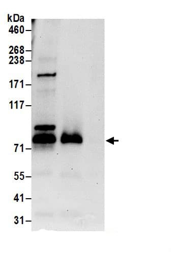 Immunoprecipitation:SDAD1 AntibodyNBP3-29398] -Detection of human SDAD1 by western blot of immunoprecipitates. Samples: Whole cell lysate (0.5 or 1.0 mg per IP reaction; 20% of IP loaded) from HeLa cells prepared using NETN lysis buffer. Antibodies: Affinity purified rabbit anti-SDAD1 antibody NBP3-29398 (lot NBP3-29398-1) used for IP at 6 µg per reaction. SDAD1 was also immunoprecipitated by rabbit anti-SDAD1 antibody . For blotting immunoprecipitated SDAD1, NBP3-29398 was used at 0.4 µg/ml. Detection: Chemiluminescence with an exposure time of 30 seconds.