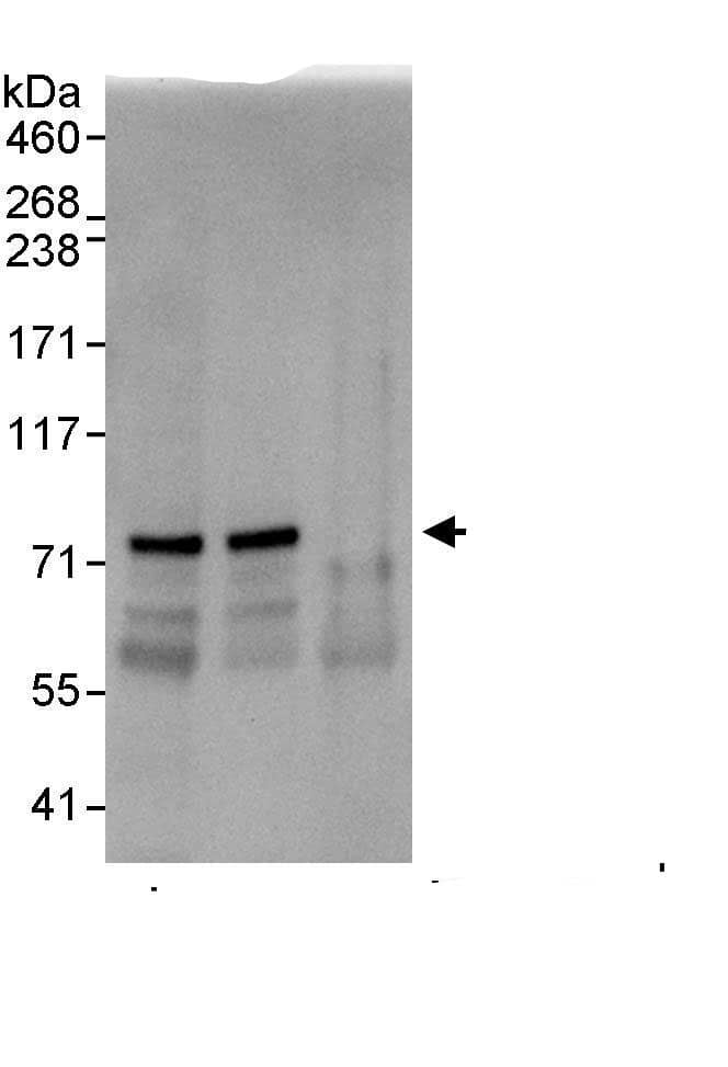 Immunoprecipitation:EIF2AK1 AntibodyNBP3-29399] -Detection of human EIF2AK1 by western blot of immunoprecipitates. Samples: Whole cell lysate (1 mg for IP, 20% of IP loaded) from HeLa cells. Antibodies: Affinity purified rabbit anti-EIF2AK1 antibody NBP3-29399 used for IP at 10 µg/mg lysate. EIF2AK1 was also immunoprecipitated by rabbit anti-EIF2AK1., which recognizes an upstream epitope. For blotting immunoprecipitated EIF2AK1, A302-685A was used at 1 µg/ml. Detection: Chemiluminescence with an exposure time of 10 seconds.