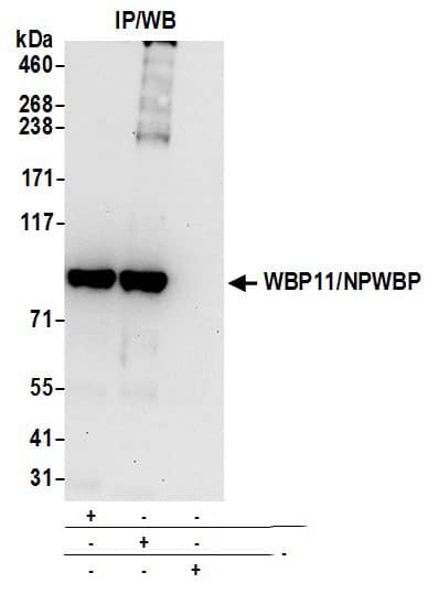 Immunoprecipitation:[NBP3-29400]-Detection of human WBP11/NPWBP by western blot of immunoprecipitates. Samples: Whole cell lysate from HeLa cells prepared using NETN lysis buffer. Antibodies: Affinity purified rabbit anti-WBP11/NPWBP antibody used for IP at 6 µg per reaction. WBP11/NPWBP was also immunoprecipitated by rabbit anti-WBP11/NPWBP antibody. For blotting immunoprecipitated WBP11/NPWBP, was used at 1 µg/ml. Detection: Chemiluminescence with an exposure time of 30 seconds.