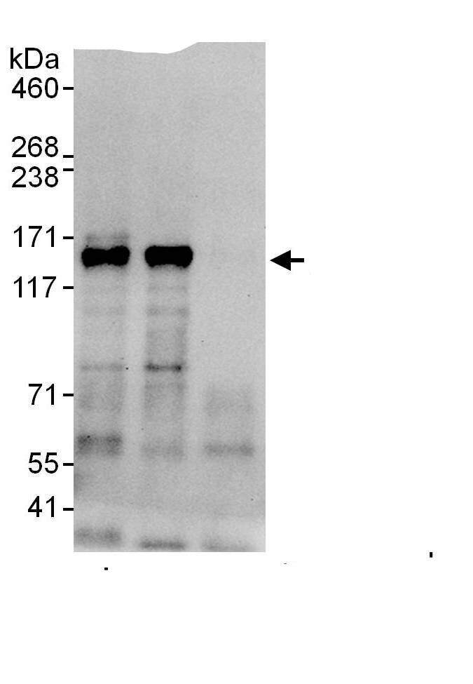 Immunoprecipitation:HDAC5 AntibodyNBP3-29402] -Detection of human HDAC5 by western blot of immunoprecipitates. Samples: Whole cell lysate (1 mg for IP, 20% of IP loaded) from HeLa cells. Antibodies: Affinity purified rabbit anti-HDAC5 antibody NBP3-29402 used for IP at 6 µg/mg lysate. HDAC5 was also immunoprecipitated by rabbit anti-HDAC5., which recognizes an upstream epitope. For blotting immunoprecipitated HDAC5, A303-463A was used at 0.4 µg/ml,. Detection: Chemiluminescence with an exposure time 30 seconds.