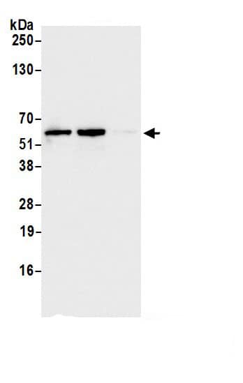 Immunoprecipitation:FAM98A AntibodyNBP3-29403] -Detection of human FAM98A by western blot of immunoprecipitates. Samples: Whole cell lysate (1.0 mg per IP reaction; 20% of IP loaded) from 293T cells prepared using NETN lysis buffer. Antibodies: Affinity purified rabbit anti-FAM98A antibody (NBP3-29403 lot 1) used for IP at 2 µg per reaction. FAM98A was also immunoprecipitated by rabbit anti-FAM98A.. For blotting immunoprecipitated FAM98A, NBP3-29403 was used at 0.1 mg/ml. Detection: Chemiluminescence with an exposure time of 1 second.