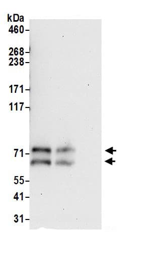 Immunoprecipitation:ZDHHC5 AntibodyNBP3-29405] -Detection of human ZDHHC5 by western blot of immunoprecipitates. Samples: Whole cell lysate (0.5 or 1.0 mg per IP reaction; 20% of IP loaded) from 293T cells prepared using NETN lysis buffer. Antibodies: Affinity purified rabbit anti-ZDHHC5 antibody NBP3-29405 (lot NBP3-29405-1) used for IP at 6 µg per reaction. ZDHHC5 was also immunoprecipitated by rabbit anti-ZDHHC5.. For blotting immunoprecipitated ZDHHC5, NBP3-29405 was used at 0.4 µg/ml. Detection: Chemiluminescence with an exposure time of 30 seconds.