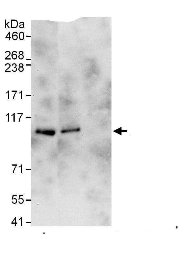 Immunoprecipitation:BICD2 AntibodyNBP3-29407] -Detection of human BICD2 by western blot of immunoprecipitates. Samples: Whole cell lysate (1 mg for IP, 20% of IP loaded) from HeLa cells. Antibodies: Affinity purified rabbit anti-BICD2 antibody NBP3-29407 used for IP at 6 µg/mg lysate. BICD2 was also immunoprecipitated by rabbit anti-BICD2., which recognizes an upstream epitope. For blotting immunoprecipitated BICD2,  was used at 0.4 µg/ml. Detection: Chemiluminescence with an exposure time of 30 seconds.