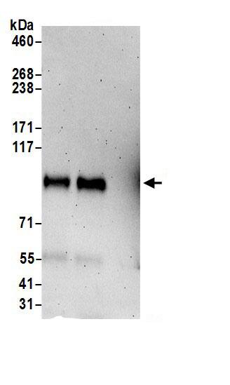 Immunoprecipitation:UNK AntibodyNBP3-29408] -Detection of human UNK by western blot of immunoprecipitates. Samples: Whole cell lysate (0.5 or 1.0 mg per IP reaction; 20% of IP loaded) from 293T cells prepared using NETN lysis buffer. Antibodies: Affinity purified rabbit anti-UNK antibody NBP3-29408 (lot NBP3-29408-1) used for IP at 6 µg per reaction. UNK was also immunoprecipitated by rabbit anti-UNK.. For blotting immunoprecipitated UNK, NBP3-29408 was used at 1 µg/ml. Detection: Chemiluminescence with an exposure time of 3 minutes.