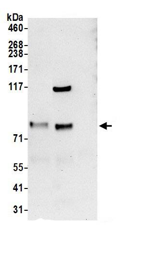 Immunoprecipitation:NOA1 AntibodyNBP3-29409] -Detection of human NOA1 by western blot of immunoprecipitates. Samples: Whole cell lysate (0.5 or 1.0 mg per IP reaction; 20% of IP loaded) from 293T cells prepared using NETN lysis buffer. Antibodies: Affinity purified rabbit anti-NOA1 antibody NBP3-29409 (lot NBP3-29409-1) used for IP at 6 µg per reaction. NOA1 was also immunoprecipitated by rabbit anti-NOA1.. For blotting immunoprecipitated NOA1, NBP3-29409 was used at 1 µg/ml. Detection: Chemiluminescence with an exposure time of 30 seconds.