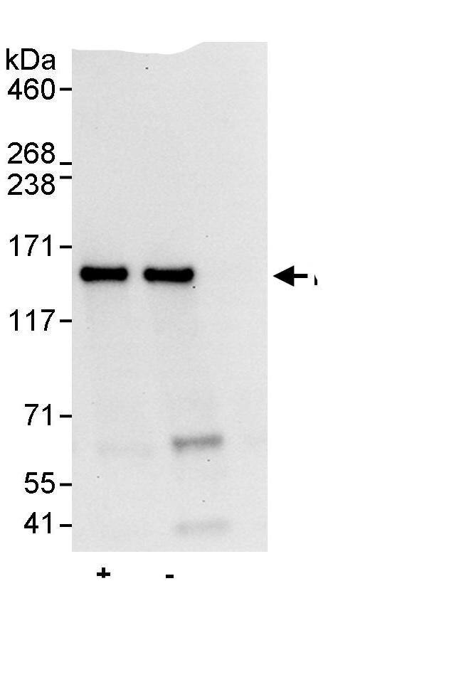 Immunoprecipitation:NUP133 AntibodyNBP3-29410] -Detection of human NUP133 by western blot of immunoprecipitates. Samples: Whole cell lysate (1 mg for IP, 20% of IP loaded) from HeLa cells. Antibodies: Affinity purified rabbit anti-NUP133 antibody NBP3-29410 used for IP at 10 µg/mg lysate. NUP133 was also immunoprecipitated by rabbit anti-NUP133., which recognizes a downstream epitope. For blotting immunoprecipitated NUP133, was used at 1 µg/ml. Detection: Chemiluminescence with an exposure time of 10 seconds.