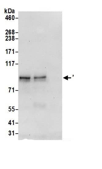 Immunoprecipitation:LZTS2 AntibodyNBP3-29411] -Detection of human LZTS2 by western blot of immunoprecipitates. Samples: Whole cell lysate (0.5 or 1.0 mg per IP reaction; 20% of IP loaded) from 293T cells prepared using NETN lysis buffer. Antibodies: Affinity purified rabbit anti-LZTS2 antibody NBP3-29411 (lot NBP3-29411-1) used for IP at 6 µg per reaction. LZTS2 was also immunoprecipitated by rabbit anti-LZTS2 antibody BL19732. For blotting immunoprecipitated LZTS2, NBP3-29411 was used at 0.1 µg/ml. Detection: Chemiluminescence with an exposure time of 30 seconds.