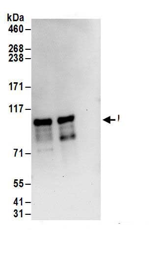 Immunoprecipitation:ZC3H14 AntibodyNBP3-29413] -Detection of human MSUT2 by western blot of immunoprecipitates. Samples: Whole cell lysate (1 mg for IP; 20% of IP loaded) from HEK293T cells. Antibodies: Affinity purified rabbit anti-MSUT2 antibody NBP3-29413 (lot NBP3-29413-1) used for IP at 6 µg/mg lysate. MSUT2 was also immunoprecipitated by rabbit anti-MSUT2.. For blotting immunoprecipitated MSUT2, NBP3-29413 was used at 1 µg/ml. Detection: Chemiluminescence with an exposure time of 10 seconds.