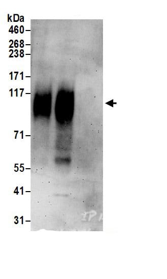 Immunoprecipitation:SLC26A2 AntibodyNBP3-29414] -Detection of human SLC26A2 by western blot of immunoprecipitates. Samples: Whole cell lysate (0.5 or 1.0 mg per IP reaction; 20% of IP loaded) from HeLa cells prepared using RIPA lysis buffer. Antibodies: Affinity purified rabbit anti-SLC26A2 antibody NBP3-29414 (lot NBP3-29414-1) used for IP at 6 µg per reaction. SLC26A2 was also immunoprecipitated by rabbit anti-SLC26A2.. For blotting immunoprecipitated SLC26A2, NBP3-29414 was used at 1 µg/ml. Detection: Chemiluminescence with an exposure time of 3 minutes.