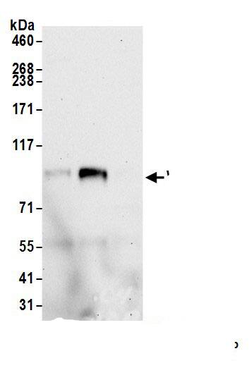 Immunoprecipitation:WDR6 AntibodyNBP3-29416] -Detection of human WDR6 by western blot of immunoprecipitates. Samples: Whole cell lysate (1.0 mg per IP reaction; 20% of IP loaded) from HEK293T cells prepared using NETN lysis buffer. Antibodies: Affinity purified rabbit anti-WDR6 antibody (NBP3-29416 lot 1) used for IP at 6 µg per reaction. WDR6 was also immunoprecipitated by rabbit anti-WDR6 antibody . For blotting immunoprecipitated WDR6,  was used at 0.4 mg/ml. Detection: Chemiluminescence with an exposure time of 75 seconds.