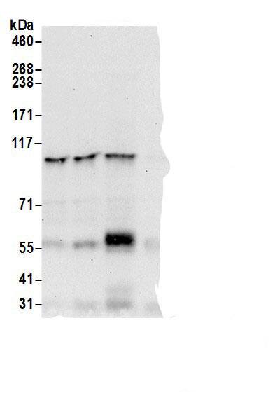 Immunoprecipitation:NEDD4 AntibodyNBP3-29418] -Detection of human NEDD4 by western blot of immunoprecipitates. Samples: Whole cell lysate (0.5 or 1.0 mg per IP reaction; 20% of IP loaded) from HEK293T cells prepared using NETN lysis buffer. Antibodies: Affinity purified rabbit anti-NEDD4 antibody NBP3-29418 (lot NBP3-29418-2) used for IP at 6 µg per reaction. NEDD4 was also immunoprecipitated by a previous lot of this antibody (lot NBP3-29418-1) and rabbit anti-NEDD4.. For blotting immunoprecipitated NEDD4, . was used at 1.0 µg/ml. Detection: Chemiluminescence with an exposure time of 30 seconds.