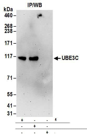 Immunoprecipitation:[NBP3-29419]-Detection of human UBE3C by western blot of immunoprecipitates. Samples: Whole cell lysate from 293T cells. Antibodies: Affinity purified rabbit anti-UBE3C antibody used for IP at 6 µg/mg lysate. UBE3C was also immunoprecipitated by rabbit anti-UBE3C antibody. For blotting immunoprecipitated UBE3C, was used at 0. 4 µg/ml. Detection: Chemiluminescence with an exposure time of 3 minutes.