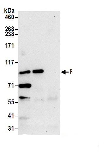 Immunoprecipitation:KLRAQ1 AntibodyNBP3-29420] -Detection of human PPP1R21 by western blot of immunoprecipitates. Samples: Whole cell lysate (1.0 mg per IP reaction; 20% of IP loaded) from Jurkat cells prepared using NETN lysis buffer. Antibodies: Affinity purified rabbit anti-PPP1R21 antibody (NBP3-29420 lot 1) used for IP at 6 µg per reaction. PPP1R21 was also immunoprecipitated by rabbit anti-PPP1R21.. For blotting immunoprecipitated PPP1R21, was used at 0.4 mg/ml. Detection: Chemiluminescence with an exposure time of 30 seconds.