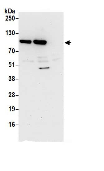 Immunoprecipitation:PDXDC1 AntibodyNBP3-29421] -Detection of human PDXDC1 by western blot of immunoprecipitates. Samples: Whole cell lysate (0.5 or 1.0 mg per IP reaction; 20% of IP loaded) from 293T cells prepared using NETN lysis buffer. Antibodies: Affinity purified rabbit anti-PDXDC1 antibody NBP3-29421 (lot NBP3-29421-1) used for IP at 6 µg per reaction. PDXDC1 was also immunoprecipitated by rabbit anti-PDXDC1.. For blotting immunoprecipitated PDXDC1, NBP3-29421 was used at 1 µg/ml. Detection: Chemiluminescence with an exposure time of 30 seconds.