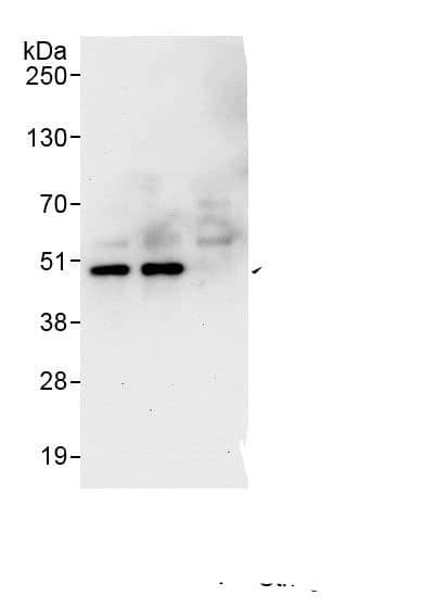 Immunoprecipitation:BCKDHA AntibodyNBP3-29423] -Detection of human BCKDHA by western blot of immunoprecipitates. Samples: Whole cell lysate (1 mg for IP, 20% of IP loaded) from HeLa cells. Antibodies: Affinity purified rabbit anti-BCKDHA antibody NBP3-29423 (lot NBP3-29423-1) used for IP at 6 µg/mg lysate. BCKDHA was also immunoprecipitated by rabbit anti-BCKDHA., which recognizes a downstream epitope. For blotting immunoprecipitated BCKDHA,  was used at 1 µg/ml. Detection: Chemiluminescence with an exposure time of 30 seconds.