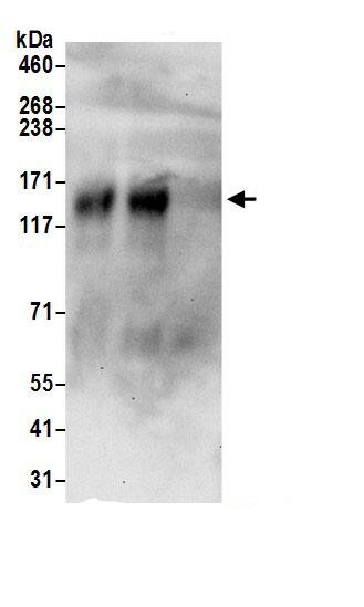 Immunoprecipitation:KCC3/SLC12A6 AntibodyNBP3-29424] -Detection of human KCC3 by western blot of immunoprecipitates. Samples: Whole cell lysate (1 mg for IP; 20% of IP loaded) prepared using RIPA buffer from Jurkat cells. Antibodies: Affinity purified rabbit anti-KCC3 antibody NBP3-29424 (lot NBP3-29424-1) used for IP at 6 µg per reaction. KCC3 was also immunoprecipitated by rabbit anti-KCC3 antibody for blotting immunoprecipitated KCC3, A304-409A-1 was used at 1 µg/ml. Detection: Chemiluminescence with an exposure time of 30 seconds.