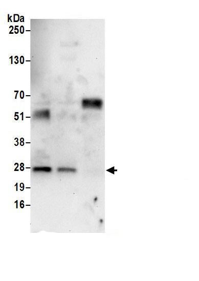 Immunoprecipitation:PDCD10 AntibodyNBP3-29426] -Detection of human PDCD10/CCM3 by western blot of immunoprecipitates. Samples: Whole cell lysate (0.5 or 1.0 mg per IP reaction; 20% of IP loaded) from HeLa cells prepared using NETN lysis buffer. Antibody: Affinity purified rabbit anti-PDCD10/CCM3 antibody NBP3-29426 (lot NBP3-29426-1) used for IP at 6 µg per reaction. PDCD10/CCM3 was also immunoprecipitated by rabbit anti-PDCD10/CCM3 antibody BL18455. For blotting immunoprecipitated PDCD10/CCM3, NBP3-29426 was used at 0.4 µg/ml. Detection: Chemiluminescence with an exposure time of 30 seconds.