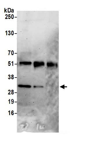 Immunoprecipitation:CMSS1 AntibodyNBP3-29429] -Detection of human CMSS1 by western blot of immunoprecipitates. Samples: Whole cell lysate (0.5 or 1.0 mg per IP reaction; 20% of IP loaded) from 293T cells prepared using NETN lysis buffer. Antibodies: Affinity purified rabbit anti-CMSS1 antibody NBP3-29429 (lot NBP3-29429-1) used for IP at 6 µg per reaction. CMSS1 was also immunoprecipitated by rabbit anti-CMSS1 antibody . For blotting immunoprecipitated CMSS1, NBP3-29429 was used at 1 µg/ml. Detection: Chemiluminescence with an exposure time of 3 minutes.