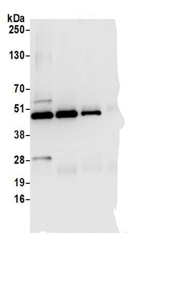 Immunoprecipitation:Perilipin-3/TIP47 AntibodyNBP3-29430] -Detection of human PLIN3 by western blot of immunoprecipitates. Samples: Whole cell lysate (0.5 or 1.0 mg per IP reaction; 20% of IP loaded) from 293T cells prepared using NETN lysis buffer. Antibodies: Affinity purified rabbit anti-PLIN3 antibody NBP3-29430 (lot NBP3-29430-1) used for IP at 6 µg per reaction. PLIN3 was also immunoprecipitated by rabbit anti-PLIN3 antibodies A305-338A and BL31148. For blotting immunoprecipitated PLIN3, NBP3-29430 was used at 1 µg/ml. Detection: Chemiluminescence with an exposure time of 10 seconds.