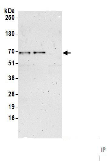 Immunoprecipitation:SNX33 AntibodyNBP3-29433] -Detection of human SNX33 by western blot of immunoprecipitates. Samples: Whole cell lysate (1.0 mg per IP reaction; 20% of IP loaded) from MCF-7 cells prepared using NETN lysis buffer. Antibodies: Affinity purified rabbit anti-SNX33 antibody (NBP3-29433 lot 1) used for IP at 6 µg per reaction. SNX33 was also immunoprecipitated by rabbit anti-SNX33 antibody BL23109. For blotting immunoprecipitated SNX33, NBP3-29433 was used at 0.4 mg/ml. Detection: Chemiluminescence with an exposure time of 3 minutes.