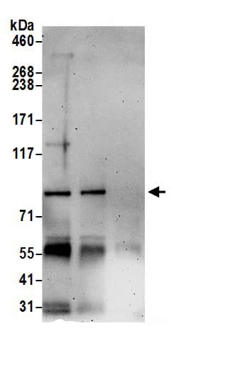 Immunoprecipitation:COG5 AntibodyNBP3-29434] -Detection of human COG5 by western blot of immunoprecipitates. Samples: Whole cell lysate (0.5 or 1.0 mg per IP reaction; 20% of IP loaded) from 293T cells prepared using NETN lysis buffer. Antibodies: Affinity purified rabbit anti-COG5 antibody NBP3-29434 (lot NBP3-29434-1) used for IP at 6 µg per reaction. COG5 was also immunoprecipitated by rabbit anti-COG5 antibody BL21591. For blotting immunoprecipitated COG5, NBP3-29434 was used at 1 µg/ml. Detection: Chemiluminescence with an exposure time of 3 minutes.