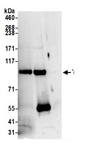 Immunoprecipitation:TSR1 AntibodyNBP3-29435] -Detection of human TSR1 by western blot of immunoprecipitates. Samples: Whole cell lysate (0.5 or 1.0 mg per IP reaction; 20% of IP loaded) from 293T cells prepared using NETN lysis buffer. Antibodies: Affinity purified rabbit anti-TSR1 antibody NBP3-29435 (lot NBP3-29435-1) used for IP at 6 µg per reaction. TSR1 was also immunoprecipitated by rabbit anti-TSR1.. For blotting immunoprecipitated TSR1, NBP3-29435 was used at 1 µg/ml. Detection: Chemiluminescence with an exposure time of 30 seconds.